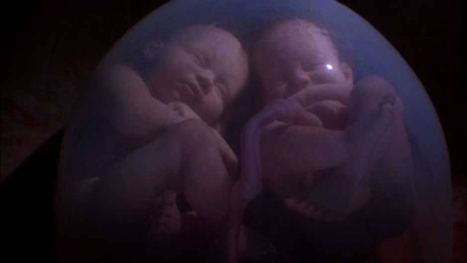 identical-twins-photos-in-the-womb-national-geographic-channel-india