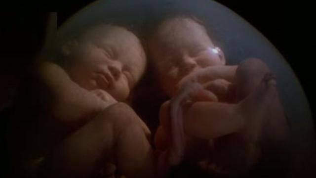 Watch In The Womb Multiples Online Free